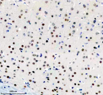 BIRC3 Antibody / Baculoviral IAP repeat-containing protein 2 / cIAP2, 100ul