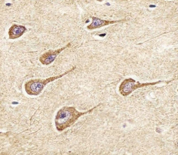 IHC testing of FFPE human brain tissue with NPY2R antibody. HIER: steam section in pH6 citrate buffe
