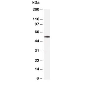 Western blot testing of Beta Tubulin antibody and rat skeletal muscle tissue lysate. Predicted molec