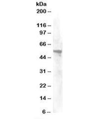 Western blot testing of HeLa lysate with Annexin A11 antibody at 0.2ug/ml. Predicted molecular weigh
