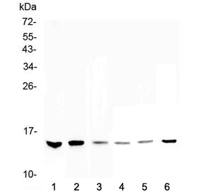 Western blot testing of 1) human HeLa, 2) human MDA-MB-231, 3) human MDA-MB-451, 4) rat thymus, 5) m
