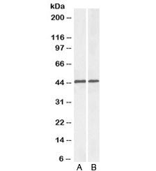 Western blot testing of mouse [A] and rat [B] liver lysate with ACAT1 antibody at 0.1ug/ml. Predicte