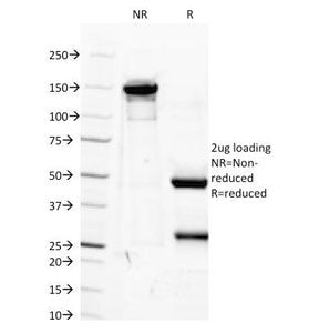 SDS-PAGE Analysis of Purified, BSA-Free IGF1 Antibody (clone M23). Confirmation of Integrity and Pur