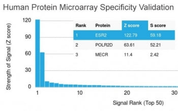 Analysis of HuProt(TM) microarray containing more than 19,000 full-length human proteins using Estro