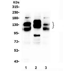 Western blot testing of 1) rat brain, 2) rat C6 and 3) mouse brain lysate with NCAM1 antibody. Predi