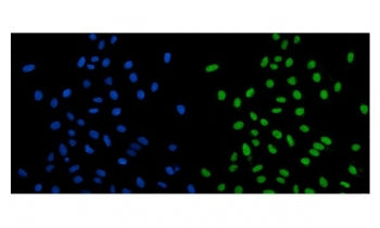 SCC112 Antibody / PSD5A