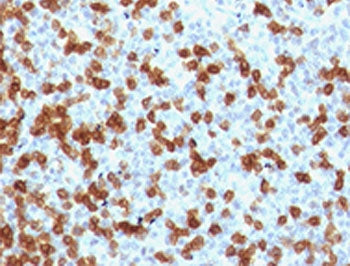 IHC testing of FFPE human tonsil with recombinant PD-1 antibody (clone RMPD1-1). HIER: steam section