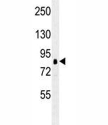 RSK1 / RPS6KA1 Antibody, 0.08ml