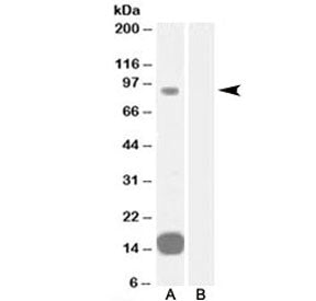 Western blot testing of human heart lysate with GRAF antibody at 0.3ug/ml with [B] and without [A] b