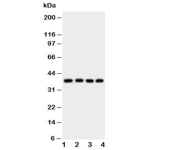Western blot testing of Bmi1 antibody and Lane 1: HeLa; 2: HT1080; 3: COLO320; 4: MCF-7 cell lysate.