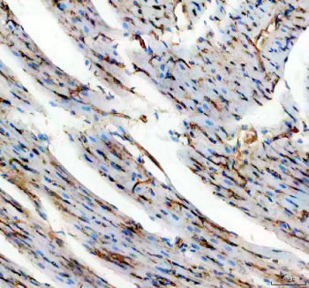 IHC staining of FFPE rat heart tissue with Cd31 antibody, HRP-secondary and DAB substrate. HIER: boi