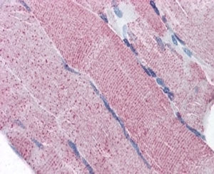 IHC testing of FFPE human skeletal muscle and PCSK6 antibody at 5ug/ml. HIER: steamed with pH6 citra