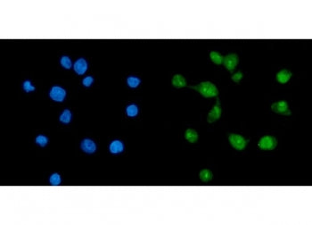 Immunofluorescent staining of FFPE human Caco-2 cells with TAF8 antibody (green) and DAPI nuclear st
