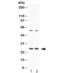 VAMP7 Antibody / SYBL1