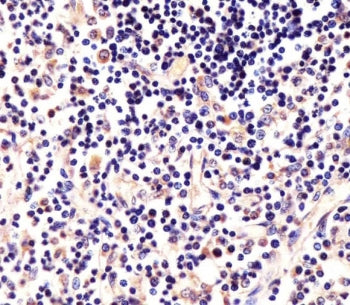 IHC testing of FFPE human thymus tissue with LCK antibody. HIER: steam section in pH6 citrate buffer