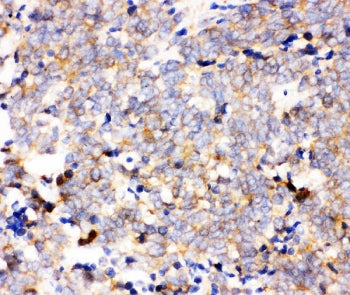 IKK alpha Antibody