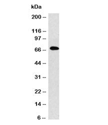 Western blot analysis of IgM antibody and Raji cell lysate (clone MuHC2). Expected molecular weight: