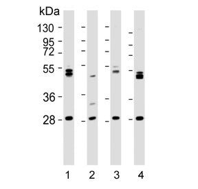 Western blot testing of human 1) 293T, 2) kidney, 3) HL60 and 4) K562 lysate with ARV1 antibody. Pre