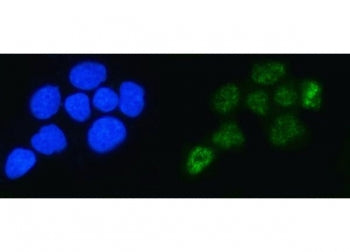 ALYREF Antibody / Tho Complex 4