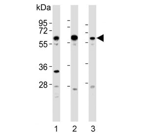 Western blot testing of human 1) HeLa, 2) HepG2 and 3) Ramos lysate with GRK5 antibody. Predicted mo