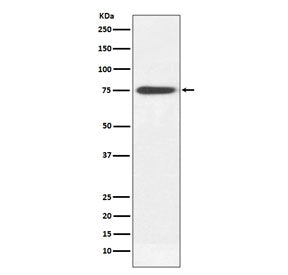 Western blot testing of human plasma lysate with Human IgM antibody. Expected molecular weight: 70-7