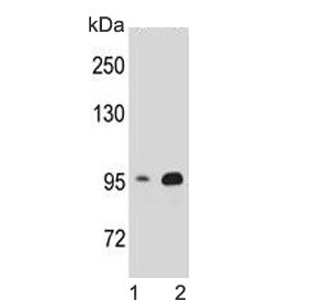 Western blot testing of human 1) HEK293 and 2) T-47D cell lysate with Catenin Beta antibody. Predict