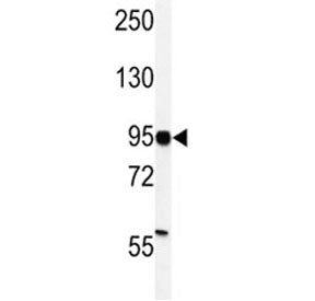 Western blot analysis of HIF-1 alpha antibody and MDA-MB231 lysate. Routinely observed molecular wei
