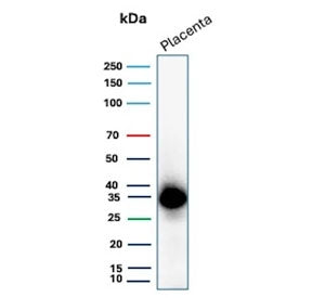 Western blot testing of human placental tissue lysate with EBI3 antibody (clone EBI3/8906). Predicte