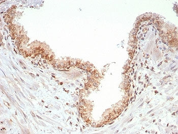 IHC staining of FFPE human prostate tissue with SMAD4 antibody (clone SMAD4/7903). HIER: boil tissue