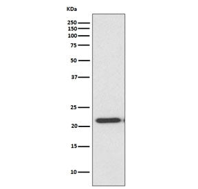 Western blot testing of human HeLa cell lysate with TIMP2 antibody. Predicted molecular weight ~24 k