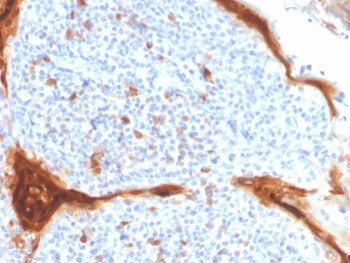 IHC staining of FFPE human tonsil tissue with Interleukin-1 Receptor Antagonist antibody (clone IL1R