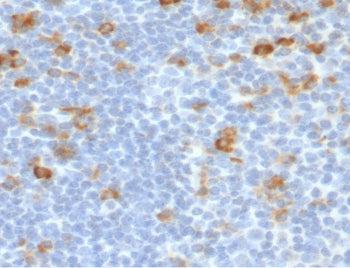 Kappa Light Chain Antibody