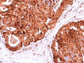 Recombinant HSP70 Antibody