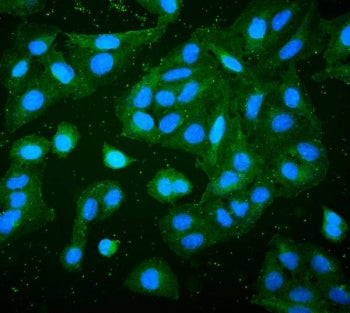 Immunofluorescent staining of FFPE human U-2 OS cells with RP2 antibody (green) and DAPI (blue). HIE