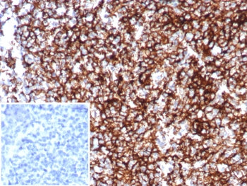 IHC staining of FFPE human tonsil tissue with CD35 antibody (clone CR1/8598R). Inset: PBS used in pl
