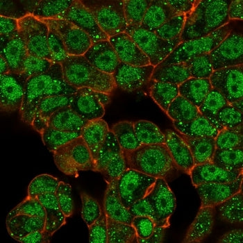 Immunofluorescent staining of human MCF-7 cells using C-terminal-binding protein 2 antibody (green, 