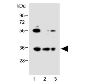 Western blot testing of human 1) HeLa, 2) 293T and 3) Jurkat cell lysate with BCKDHB antibody. Predi