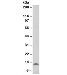 Western blot testing of colon cancer lysate with TFF3 antibody at 1ug/ml. Predicted molecular weight