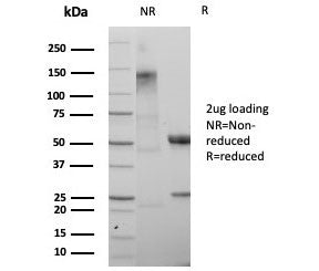 SDS-PAGE analysis of purified, BSA-free SATB2 antibody (clone rSATB2/8635) as confirmation of integr