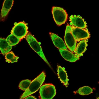 Immunofluorescent staining of PFA-fixed human HeLa cells using EIF2A antibody (green, clone PCRP-EIF