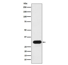 HLA-DRB1 Antibody (MHC II)