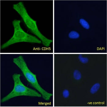 Immunofluorescent staining of fixed and permeabilized human HeLa cells with Cadherin 5 antibody (gre