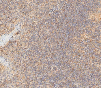 IHC testing of FFPE human tonsil tissue with HLA-B antibody. HIER: steam section in pH6 citrate buff