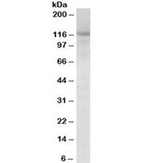 Western blot testing of mouse fetal brain lysate with SIRT1 antibody at 1ug/ml. Predicted molecular 