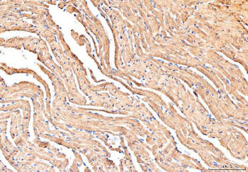 IHC staining of FFPE mouse heart tissue with PLB antibody. HIER: boil tissue sections in pH8 EDTA fo
