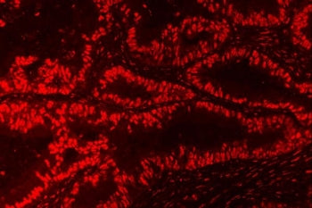Nucleophosmin Antibody