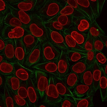 TIA-1 Antibody / T-Cell Intracellular Antigen-1