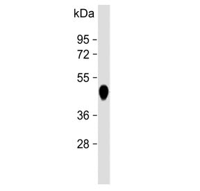 Western blot testing of human pancreas lysate with Carboxypeptidase B antibody. Predicted molecular weight ~45 kDa.