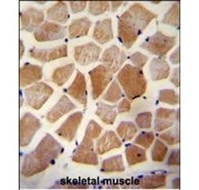 IHC staining of FFPE human skeletal muscle tissue with WISP-2 antibody. HIER: steam section in pH6 c