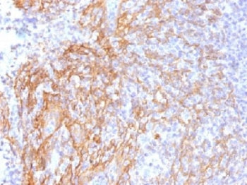IHC testing of FFPE human tonsil tissue with b-Catenin antibody (clone 6F9). Required HIER: boil tis